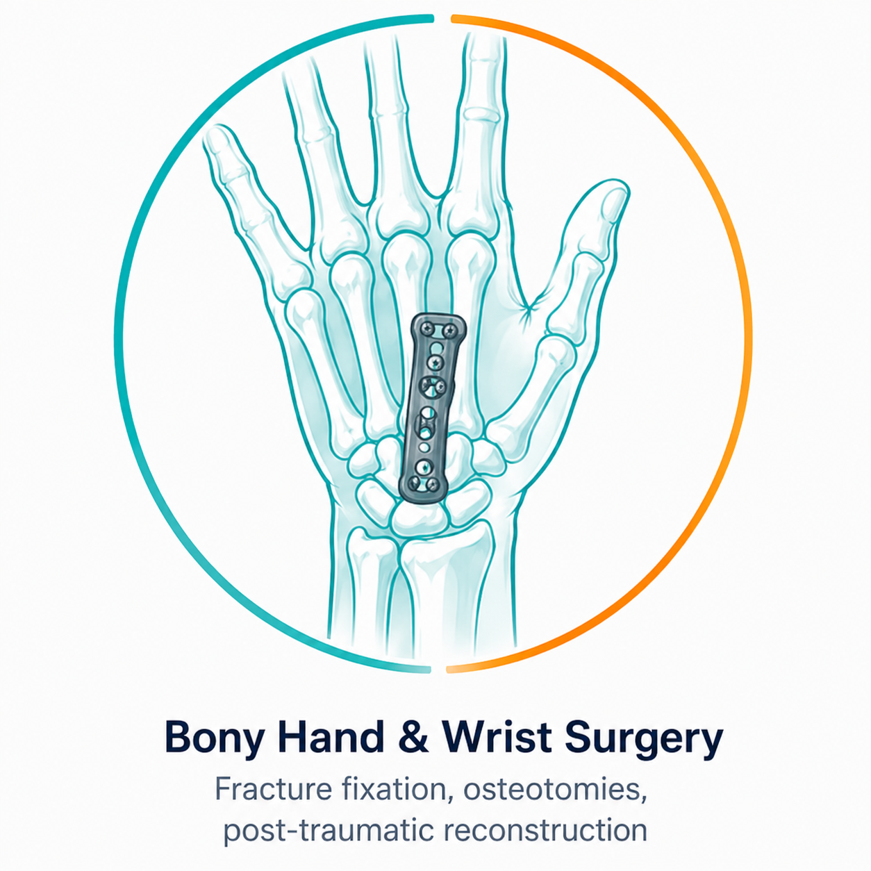 bony-hand-wrist-surgery